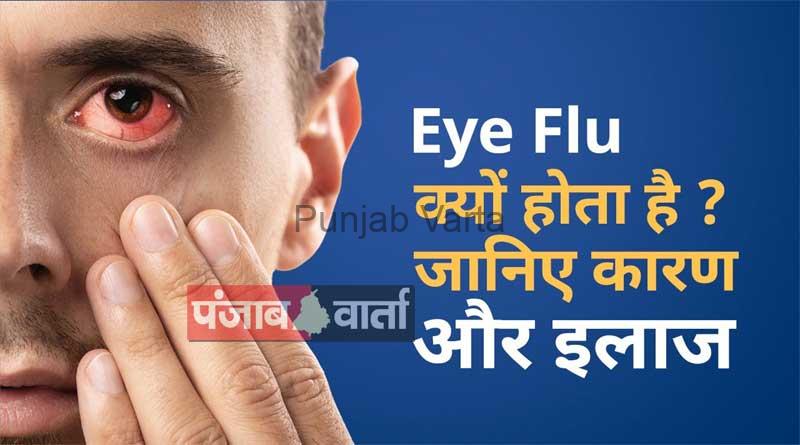 %%title%% %%page%% %%sep%% %%sitename%% Eye flu: Causes and home remedies
